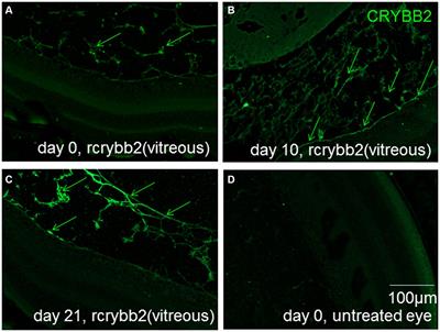 Crystallin β-b2 promotes retinal ganglion cell protection in experimental autoimmune uveoretinitis